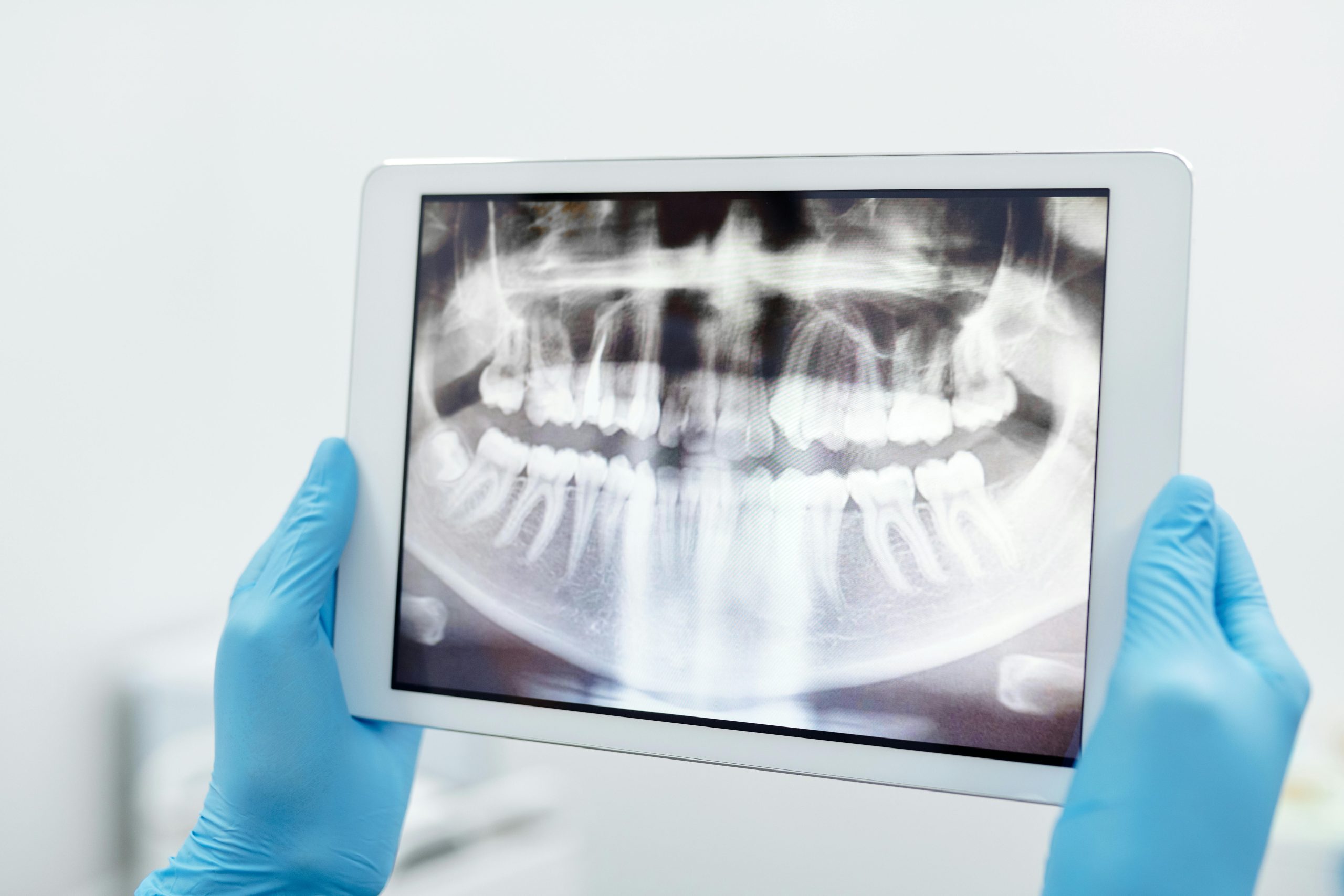 geneal dentisrty x ray