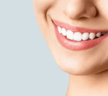 Beautiful female smile after teeth 600nw 1728530461 360x320